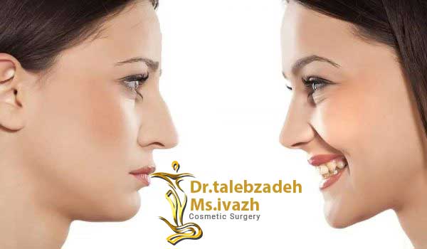 فواید عمل جراحی بینی در مشهد
